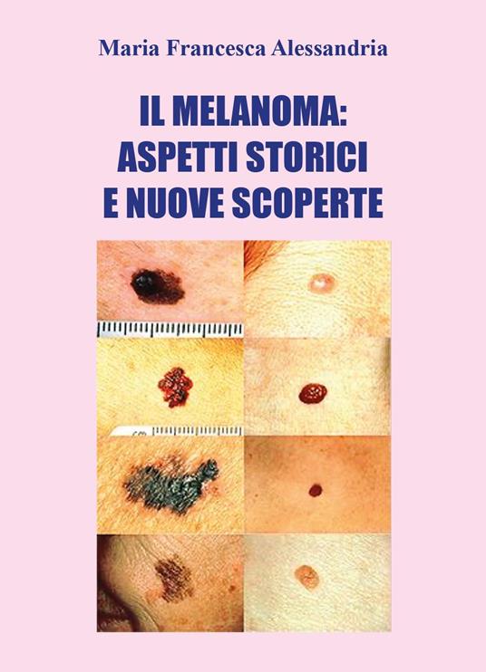 Il melanoma: aspetti storici e nuove scoperte - Maria Francesca Alessandria - copertina