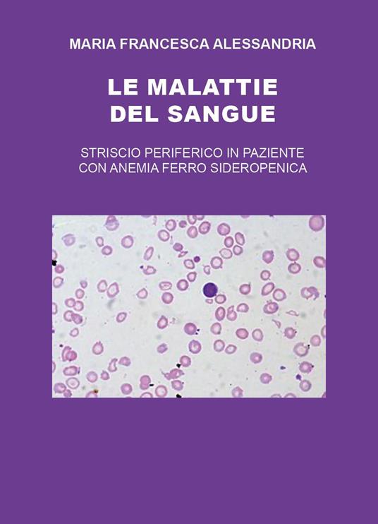 Le malattie del sangue - Maria Francesca Alessandria - copertina