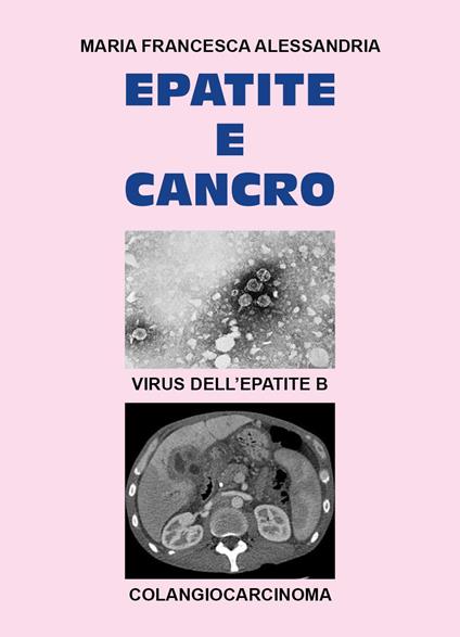 Epatite e cancro - Maria Francesca Alessandria - copertina
