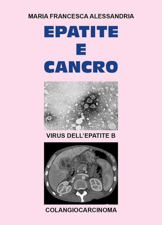 Epatite e cancro - Maria Francesca Alessandria - copertina