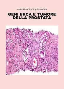 Libro Geni BRCA e tumore della prostata Maria Francesca Alessandria