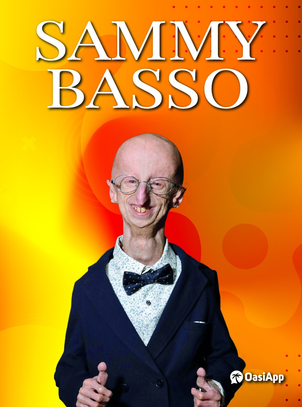 ibs
