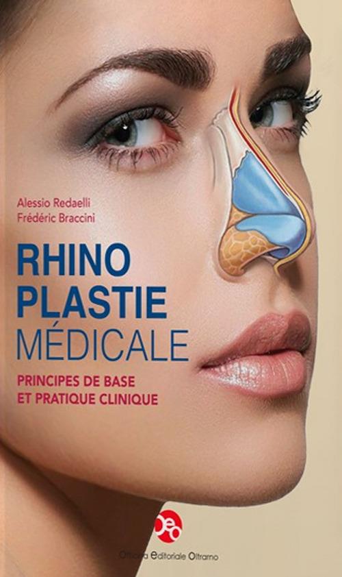 Rhinoplastie médicale. Principes de base et pratique clinique - Frédéric Braccini,Alessio Redaelli - copertina