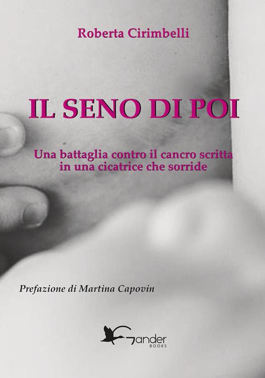 Il seno di poi. Una battaglia contro il cancro scritta in una cicatrice che sorride - Roberta Cirimbelli - copertina