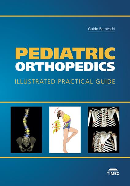 Pediatric Orthopedics. Illustrated Practical Guide. Ediz. illustrata - Guido Barneschi - copertina