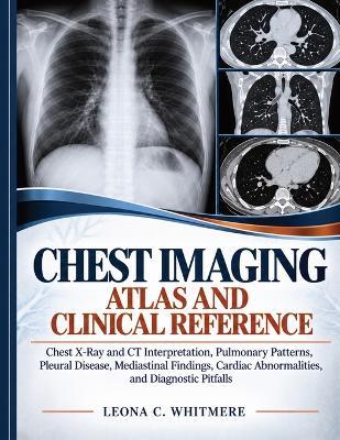 Chest Imaging Atlas and Clinical Reference: Chest X-Ray and CT Interpretation, Pulmonary Patterns, Pleural Disease, Mediastinal Findings, Cardiac Abnormalities, and Diagnostic Pitfalls - Leona C Whitmere - cover