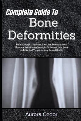 Complete Guide To Bone Deformities: Unlock Stronger, Healthier Bones And Restore Natural Alignment With Proven Strategies To Prevent Pain, Boost Mobility, And Transform Your Skeletal Health - Aurora Cedor - cover