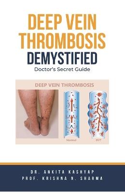 Deep Vein Thrombosis Demystified: Doctor's Secret Guide - Ankita Kashyap,Prof Krishna N Sharma - cover