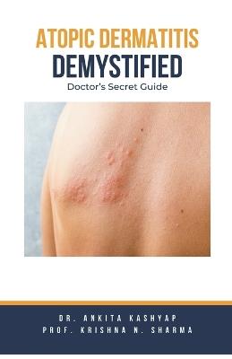 Atopic Dermatitis Demystified: Doctor's Secret Guide - Ankita Kashyap,Prof Krishna N Sharma - cover