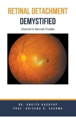 Retinal Detachment Demystified: Doctor's Secret Guide - Ankita Kashyap,Prof Krishna N Sharma - cover