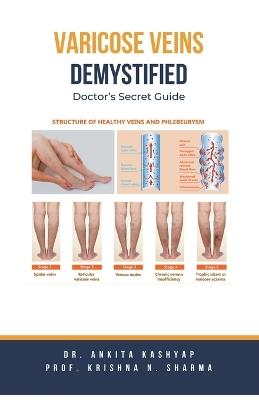 Varicose Veins Demystified: Doctor's Secret Guide - Ankita Kashyap,Prof Krishna N Sharma - cover
