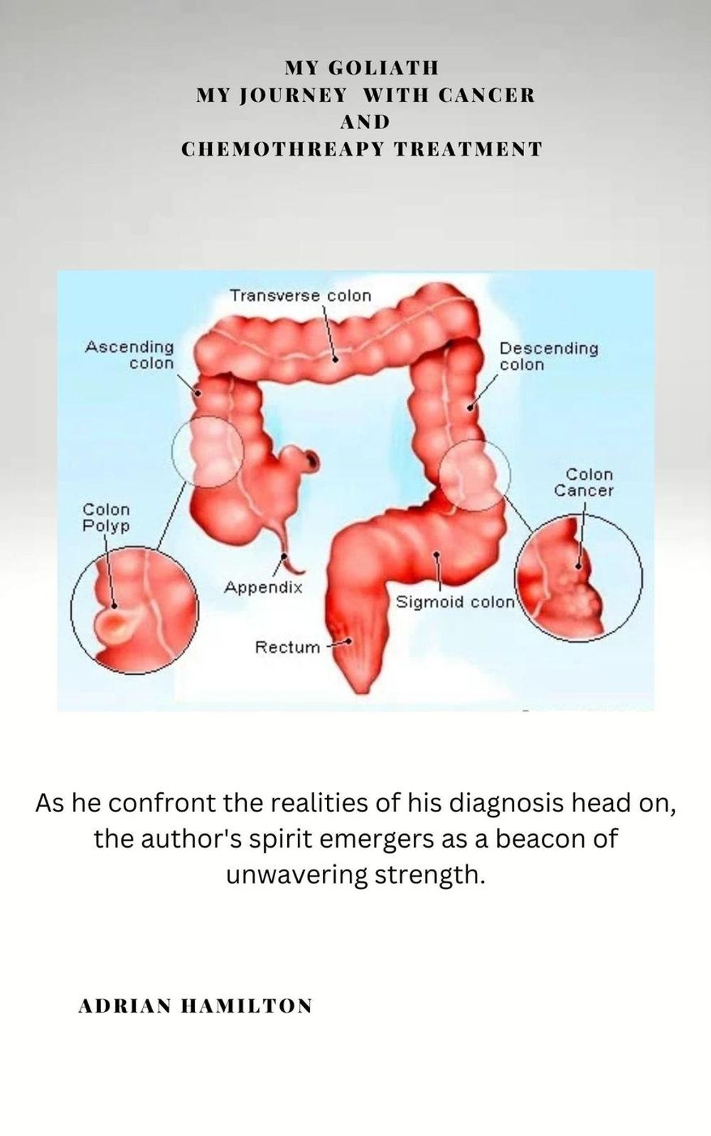 ibs