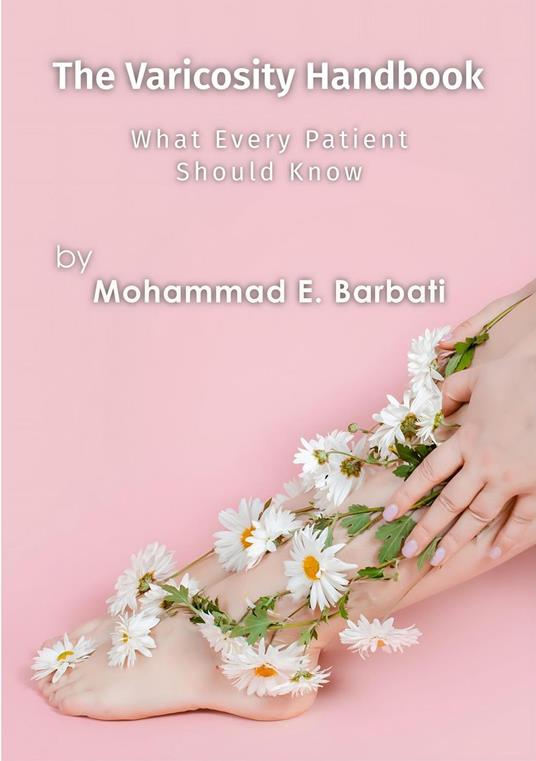 The Varicosity Handbook - What Every Patient Should Know