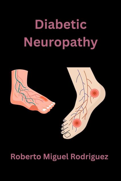 Diabetic Neuropathy