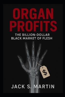 Organ Profits: The Billion-Dollar Black Market of Flesh - Jack S Martin - cover