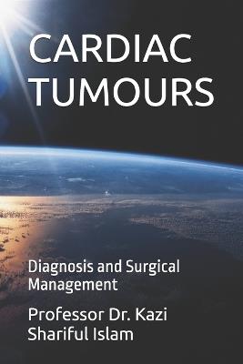 Cardiac Tumours: Diagnosis and Surgical Management - Kazi Shariful Islam - cover