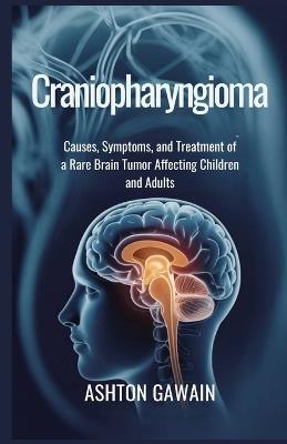 Craniopharyngioma: Causes, Symptoms, and Treatment of a Rare Brain Tumor Affecting Children and Adults - Ashton Gawain - cover