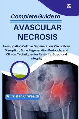 Complete Guide to Avascular Necrosis: Investigating Cellular Degeneration, Circulatory Disruption, Bone Regeneration Protocols, and Clinical Techniques for Restoring Structural Integrity - Tristan C Wealth - cover