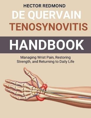 De Quervain Tenosynovitis Handbook: Managing Wrist Pain, Restoring Strength, and Returning to Daily Life - Hector Redmond - cover