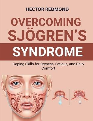 Overcoming Sjögren's Syndrome: Coping Skills for Dryness, Fatigue, and Daily Comfort - Hector Redmond - cover