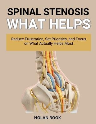 Spinal Stenosis What Helps: Reduce frustration, set priorities, and focus on what actually helps most. - Nolan Rook - cover