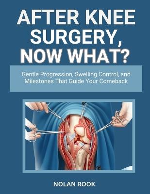 After Knee Surgery, Now What?: Gentle progression, swelling control, and milestones that guide your comeback - Nolan Rook - cover