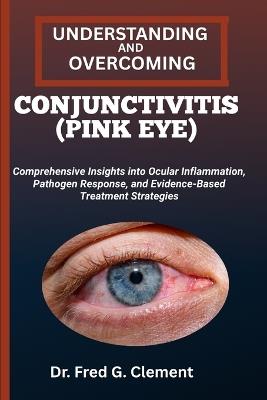 Understanding and Overcoming Conjunctivitis (Pink Eye): Comprehensive Insights into Ocular Inflammation, Pathogen Response, and Evidence-Based Treatment Strategies - Fred G Clement - cover