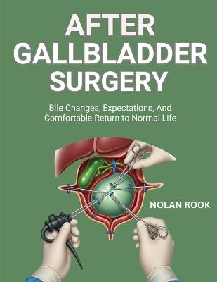 After Gallbladder Surgery: Bile changes, expectations, and comfortable return to normal life - Nolan Rook - cover