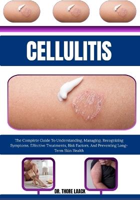 Cellulitis: The Complete Guide To Understanding, Managing, Recognizing Symptoms, Effective Treatments, Risk Factors, And Preventing Long-Term Skin Health - Thore Laack - cover