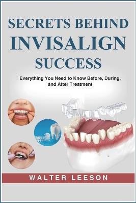 Secrets Behind Invisalign Success - Walter Leeson - cover