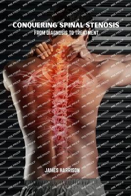 Conquering spinal stenosis: From diagnosis to treatment - James Harrison - cover