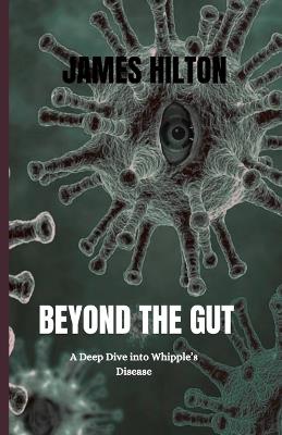 Beyond the Gut: A Deep Dive into Whipple's Disease - James Hilton - cover