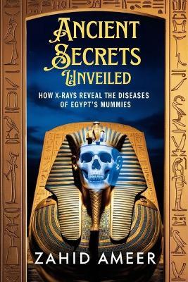 Ancient Secrets Unveiled: How X-Rays Reveal the Diseases of Egypt's Mummies - Zahid Ameer - cover