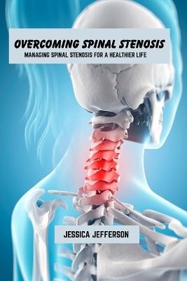 Overcoming spinal stenosis: Managing spinal stenosis for a healthier life - Jessica Jefferson - cover