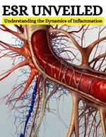Esr Unveiled: Understanding the Dynamics of Inflammation