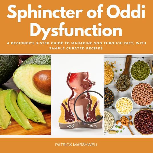 Sphincter of Oddi Dysfunction