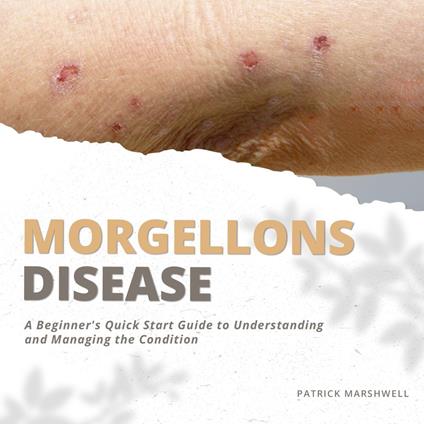 Morgellons Disease