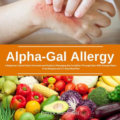 Alpha-Gal Allergy