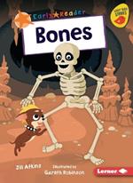 Bones