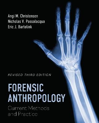 Forensic Anthropology: Current Methods and Practice - Angi M Christensen,Nicholas V Passalacqua,Eric J Bartelink - cover