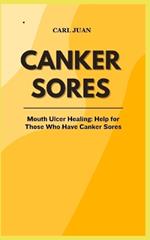 Canker Sores: Mouth Ulcer Healing: Help for Those Who Have Canker Sores