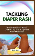 Diaper Rash: Home Solutions for Babies' Comfort: Diaper Rash Signs and Natural Remedies
