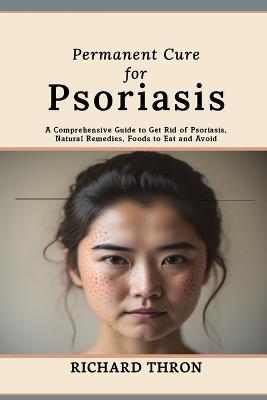Permanent Cure for Psoriasis: A Comprehensive Guide to Get Rid of Psoriasis, Natural Remedies, Foods to Eat and Avoid - Richard Thron - cover