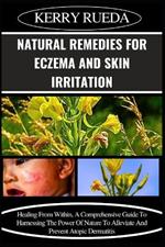 Natural Remedies for Eczema and Skin Irritation: Healing From Within, A Comprehensive Guide To Harnessing The Power Of Nature To Alleviate And Prevent Atopic Dermatitis