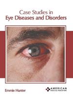 Case Studies in Eye Diseases and Disorders