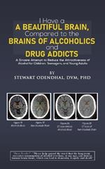 I Have a Beautiful Brain, Compared to the Brains of Alcoholics and Drug Addicts: A Sincere Attempt to Reduce the Attractiveness of Alcohol for Children, Teenagers, and Young Adults