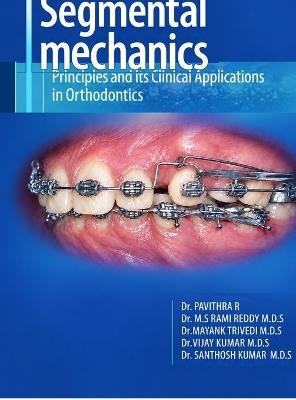 Segmental mechanics: principles and its clinical applications in orthodontics - Pavithra Rajendran - cover