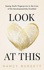 Look at This: Seeing God's Fingerprints in the Lives of the Developmentally Disabled